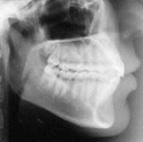 Radiologia Odontológica em Simões Filho